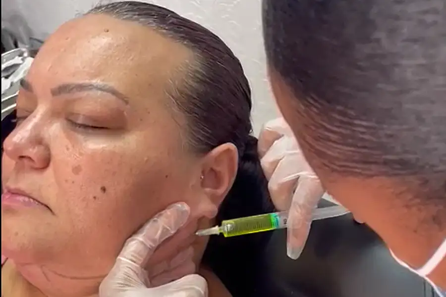 Transform Your Beauty Career with Lemon Fat Dissolve Training